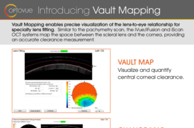 Optovue_Introducing_Vault_Mapping_fl_xxx_en.pdf