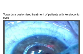 KERARING_Ophth-TimesSept19-Towards-a-customised-treatment-keratoconic-eyes_pb_xxx_en.pdf