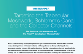 NovaEye_iTrack_Targeting-Trabecular-Meshwork_wp_xxx_en.pdf
