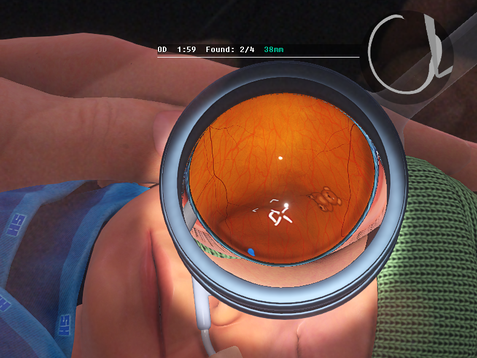 Eyesi Indirect ROP simulator, peripheral navigation training task in course A2